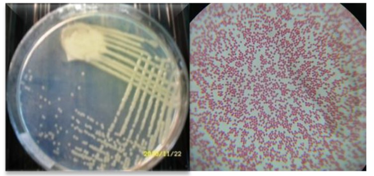 Using Cellulolytic Nitrogen Fixing Bacterium, <i>Azomonas agilis</i> for Effective Degradation of Agricultural Residues.