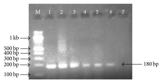 Risk of Shiga Toxigenic <i>Escherichia coli</i> O157:H7 Infection from Raw and Fermented Milk in Sokoto Metropolis, Nigeria.