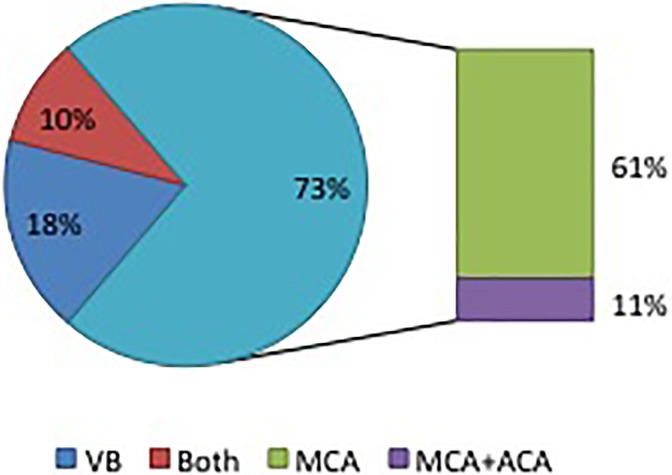 Pediatric Arterial Ischemic Stroke: Clinical Presentation, Risk Factors, and Pediatric NIH Stroke Scale in a Series of Chilean Patients.