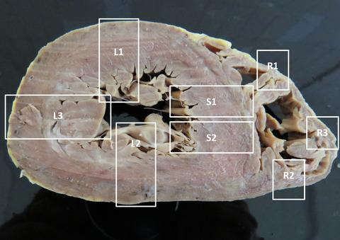 Guidelines for consistent cardiovascular post-mortem examination, sampling and reporting of lesions in European zoo-housed great apes