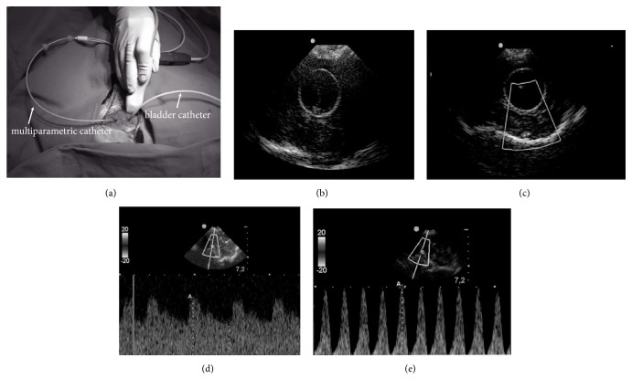 The Effects of Induction and Treatment of Intracranial Hypertension on Cerebral Autoregulation: An Experimental Study.