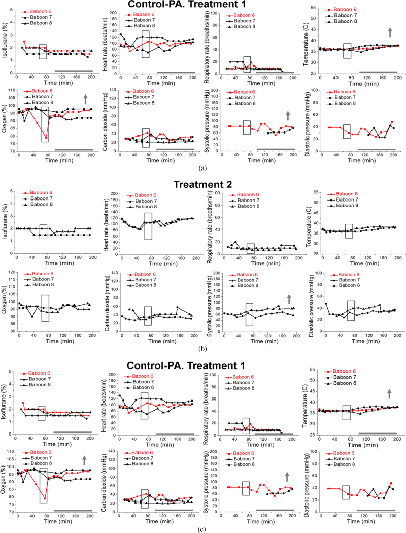 Prenatal Alcohol Exposure, Anesthesia, and Fetal Loss in Baboon Model of Pregnancy.