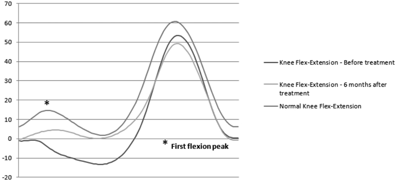 Comment on "Early Efficacy of Intra-Articular HYADD® 4 (Hymovis®) Injections for Symptomatic Knee Osteoarthritis".