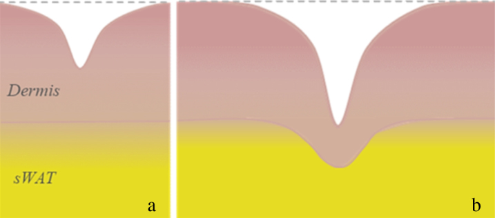 Skin aging as a mechanical phenomenon: The main weak links.