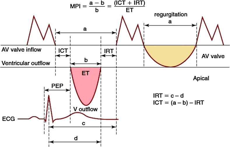 Myocardial performance index as an echocardiographic predictor of early in-hospital heart failure during first acute anterior ST-elevation myocardial infarction