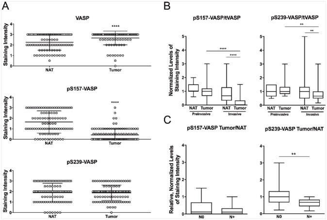 Vasodilator-Stimulated Phosphoprotein Biomarkers Are Associated with Invasion and Metastasis in Colorectal Cancer.