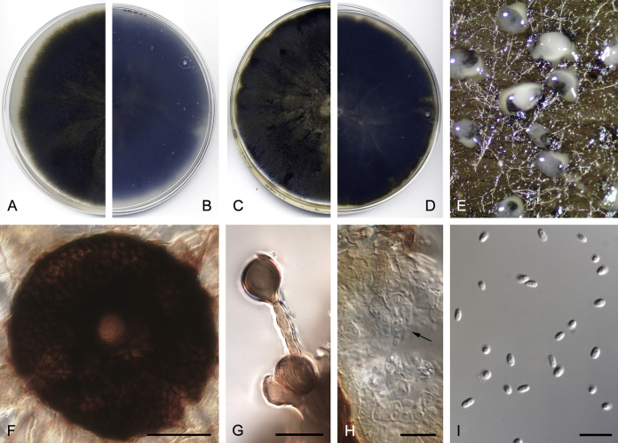 Coelomycetous Dothideomycetes with emphasis on the families Cucurbitariaceae and Didymellaceae