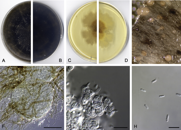 Coelomycetous Dothideomycetes with emphasis on the families Cucurbitariaceae and Didymellaceae