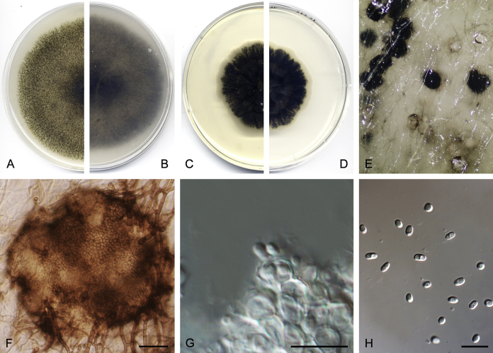 Coelomycetous Dothideomycetes with emphasis on the families Cucurbitariaceae and Didymellaceae