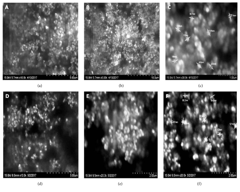 Development and Characterization of Solid Lipid Nanoparticles Containing Herbal Extract: In Vivo Antidepressant Activity.