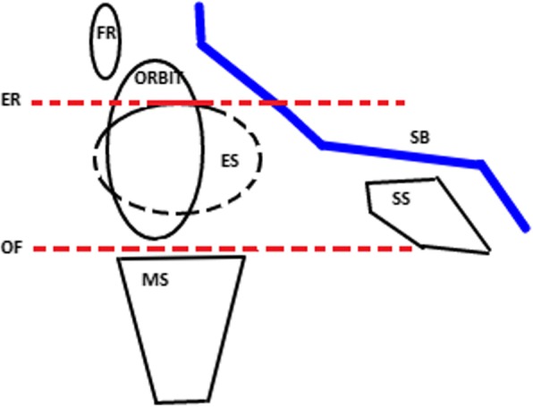 Is orbital floor a reliable and useful surgical landmark in endoscopic endonasal surgery?: a systematic review.