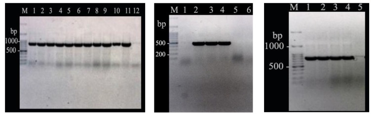 The Frequency of Antibiotic Resistance and ESBLs Among Clinically <i>Acinetobacter baumannii</i> Strains Isolated from Patients in a Major Hospital in Tehran, Iran.