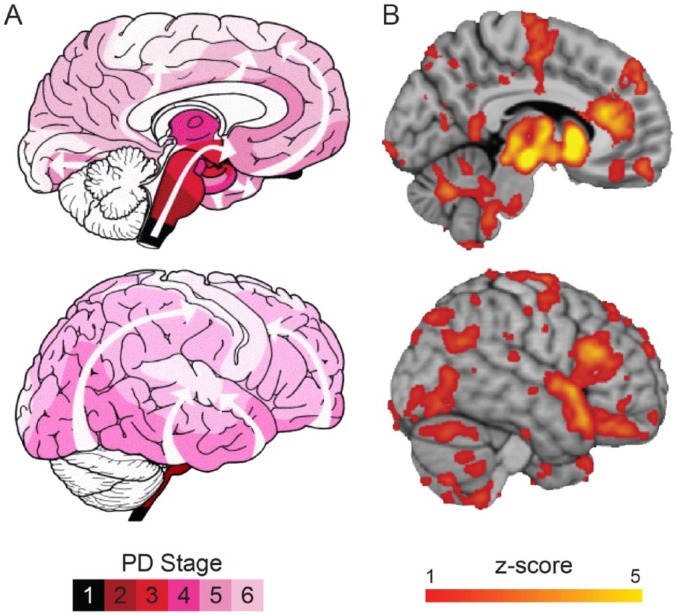 Testing the Protein Propagation Hypothesis of Parkinson Disease.