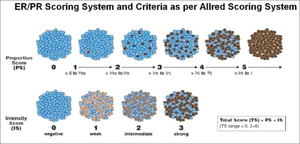 Evaluation of Immunohistochemical Profile of Breast Cancer for Prognostics and Therapeutic Use.