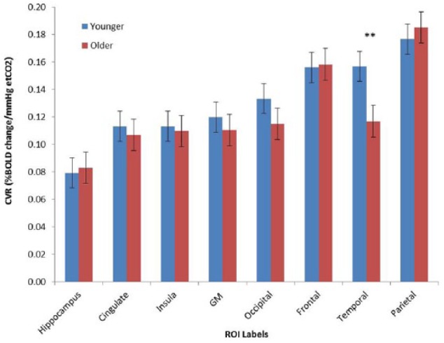 Regional Cerebrovascular Reactivity and Cognitive Performance in Healthy Aging.