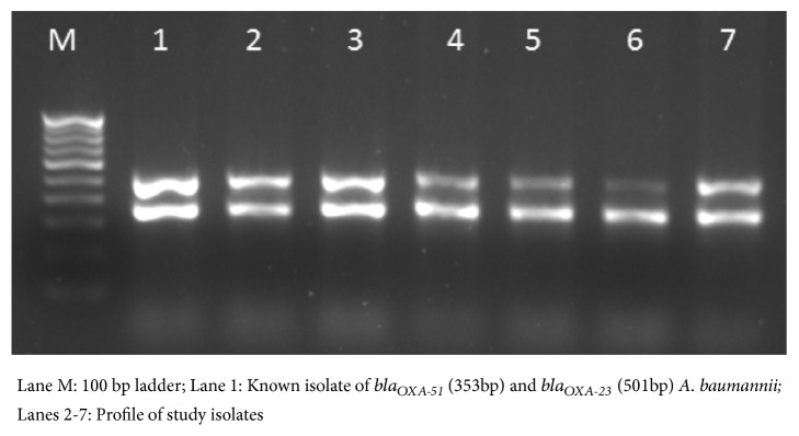 High Prevalence and Endemicity of Multidrug Resistant <i>Acinetobacter</i> spp. in Intensive Care Unit of a Tertiary Care Hospital, Varanasi, India.