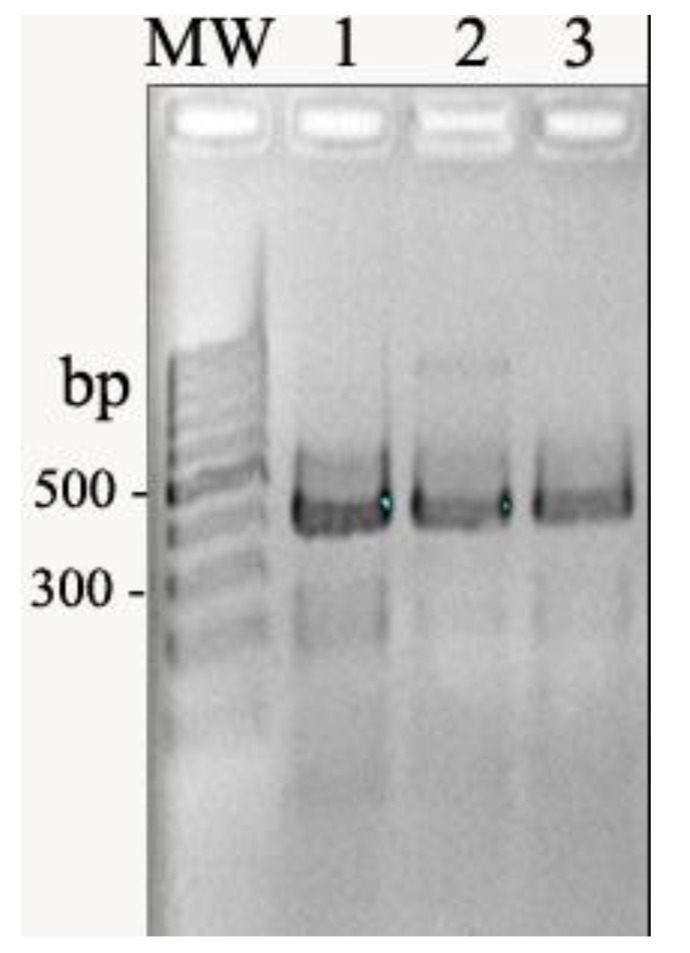 Detection of Plasmid-Mediated <i>qnr</i> Genes Among the Clinical Quinolone-Resistant <i>Escherichia coli</i> Strains Isolated in Tehran, Iran.