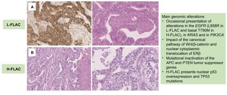 Comprehensive review of fetal adenocarcinoma of the lung.