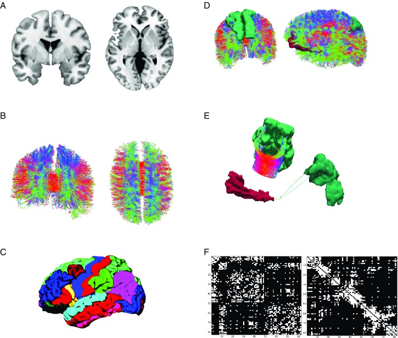 Network Neuroscience and Personality.