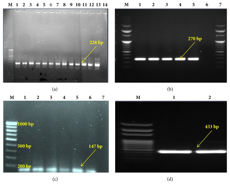 Prevalence of Panton-Valentine Leukocidin Gene among Community Acquired <i>Staphylococcus aureus</i>: A Real-Time PCR Study.