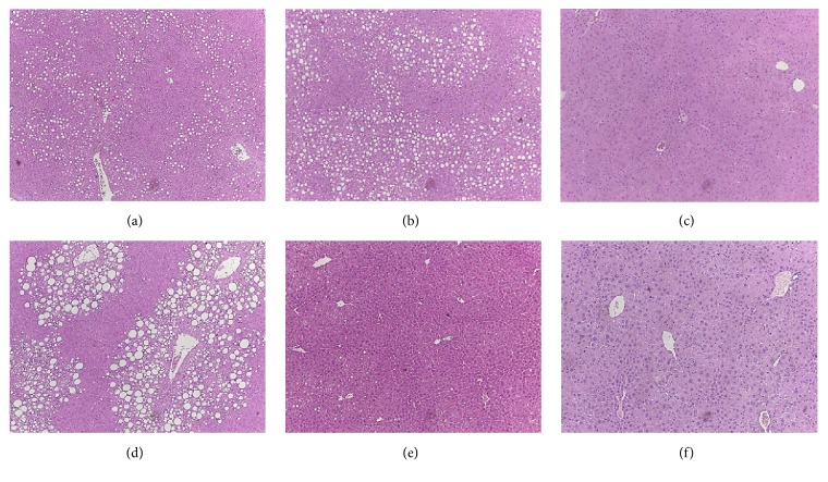 Effects of Pioglitazone on Nonalcoholic Fatty Liver Disease in the Absence of Constitutive Androstane Receptor Expression.