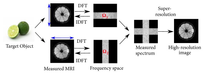 Super-Resolution of Magnetic Resonance Images via Convex Optimization with Local and Global Prior Regularization and Spectrum Fitting.