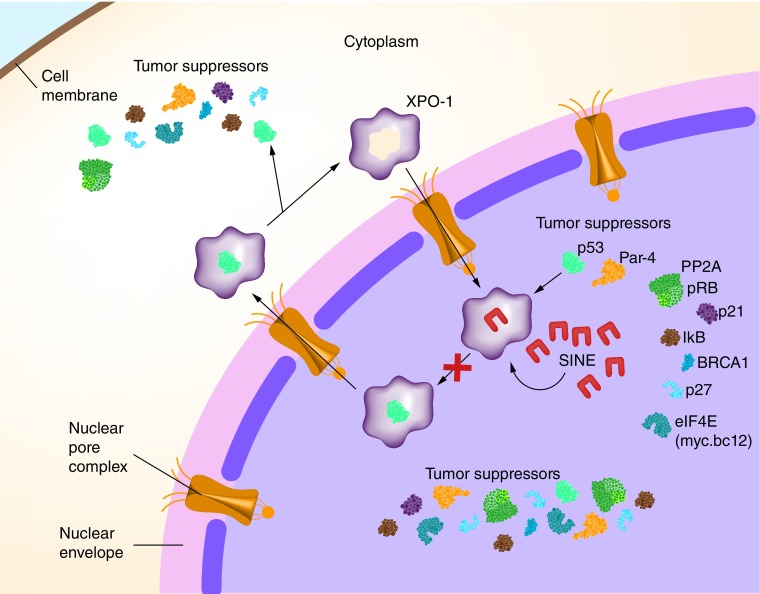 Nuclear transport inhibition in acute myeloid leukemia: recent advances and future perspectives.