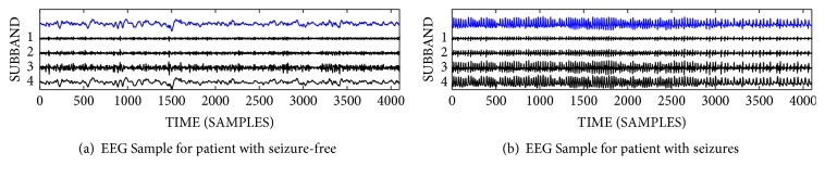 An Automated Approach for Epilepsy Detection Based on Tunable <i>Q</i>-Wavelet and Firefly Feature Selection Algorithm.