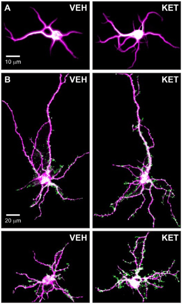 Psychoplastogens: A Promising Class of Plasticity-Promoting Neurotherapeutics.