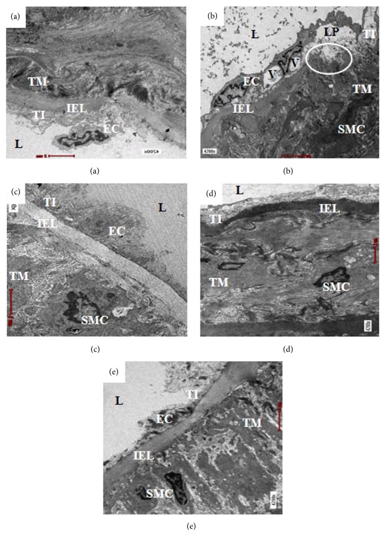 Vascular Protective Effects of <i>Morinda citrifolia</i> Leaf Extract on Postmenopausal Rats Fed with Thermoxidized Palm Oil Diet: Evidence at Microscopic Level.