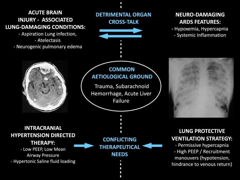 Combined lung and brain ultrasonography for an individualized "brain-protective ventilation strategy" in neurocritical care patients with challenging ventilation needs.