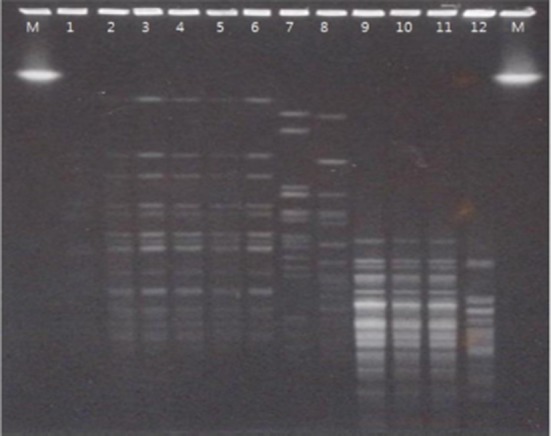 Development of a Rapid Method for the Screening of Conjugated Linoleic Acid (CLA)-Producing Strains of <i>Bifidobacterium breve</i>.