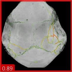 Classification based on the presence of skull fractures on curved maximum intensity skull projections by means of deep learning