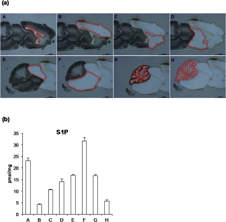 Measurement of the Spatial Distribution of S1P in Small Quantities of Tissues: Development and Application of a Highly Sensitive LC-MS/MS Method Combined with Laser Microdissection.