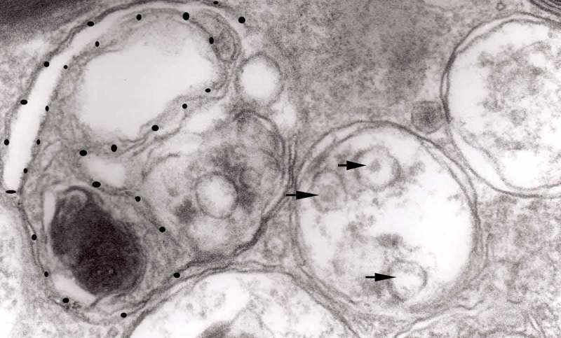 Axonal changes in experimental prion diseases recapitulate those following constriction of postganglionic branches of the superior cervical ganglion: a comparison 40 years later.