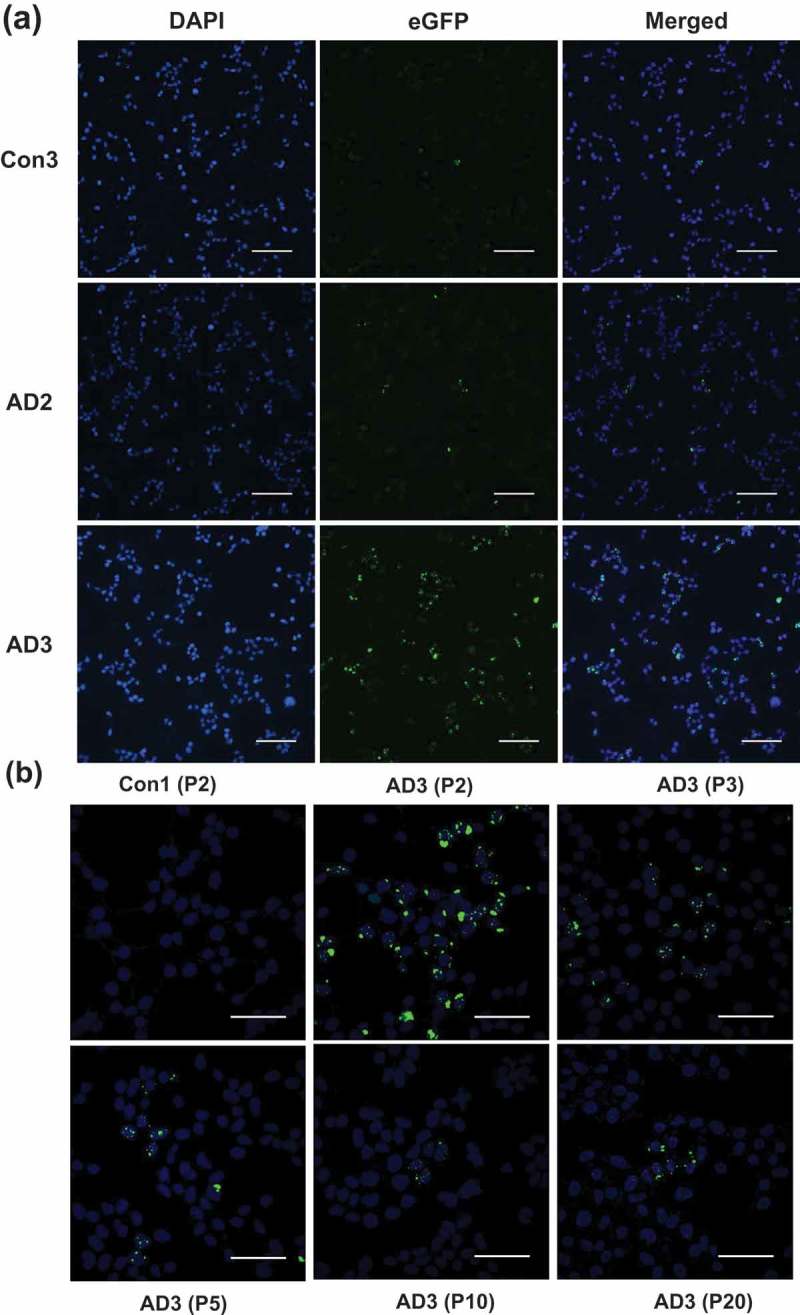 In vitro generation of tau aggregates conformationally distinct from parent tau seeds of Alzheimer's brain.