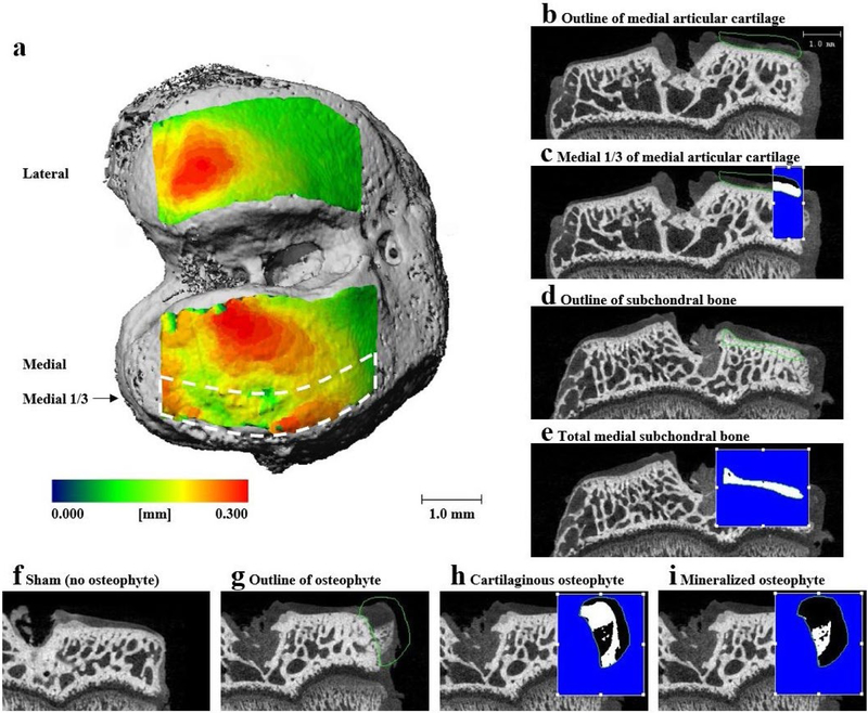 Therapeutic efficacy of intra-articular delivery of encapsulated human mesenchymal stem cells on early stage osteoarthritis.