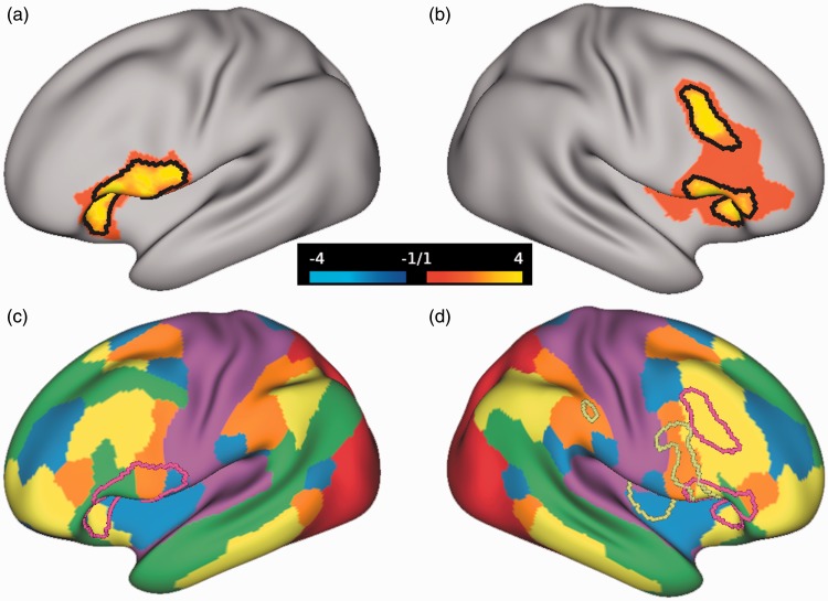 Reduced Salience and Enhanced Central Executive Connectivity Following PTSD Treatment.