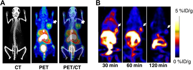 Analysis of Progress and Challenges of EGFR-Targeted Molecular Imaging in Cancer With a Focus on Affibody Molecules.