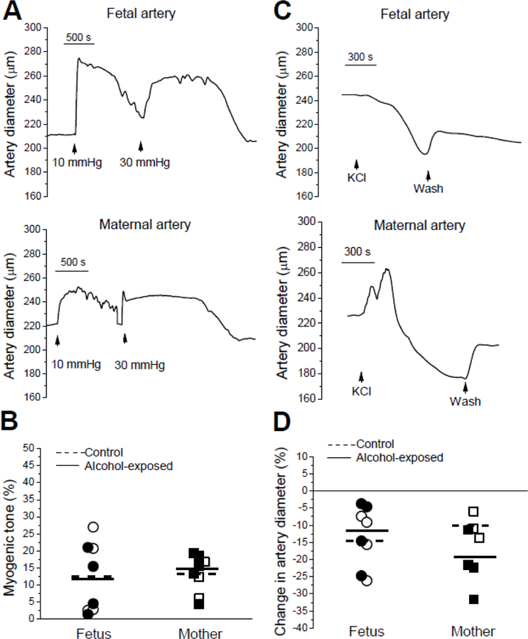 Gestational Age-Dependent Interplay between Endocannabinoid Receptors and Alcohol in Fetal Cerebral Arteries.