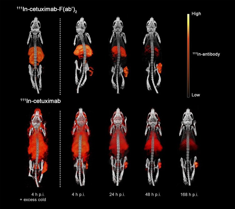 Analysis of Progress and Challenges of EGFR-Targeted Molecular Imaging in Cancer With a Focus on Affibody Molecules.