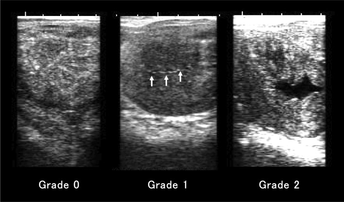 Relationship between the presence of intrauterine fluid and cervical bacteria in heavy draft mares before and after mating.