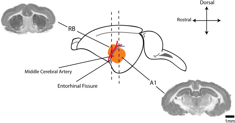 Evaluating Cholinergic Receptor Expression in Guinea Pig Primary Auditory and Rostral Belt Cortices After Noise Damage Using [<sup>3</sup>H]Scopolamine and [<sup>18</sup>F]Flubatine Autoradiography.