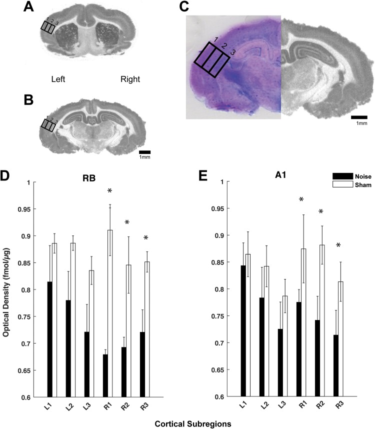 Evaluating Cholinergic Receptor Expression in Guinea Pig Primary Auditory and Rostral Belt Cortices After Noise Damage Using [<sup>3</sup>H]Scopolamine and [<sup>18</sup>F]Flubatine Autoradiography.