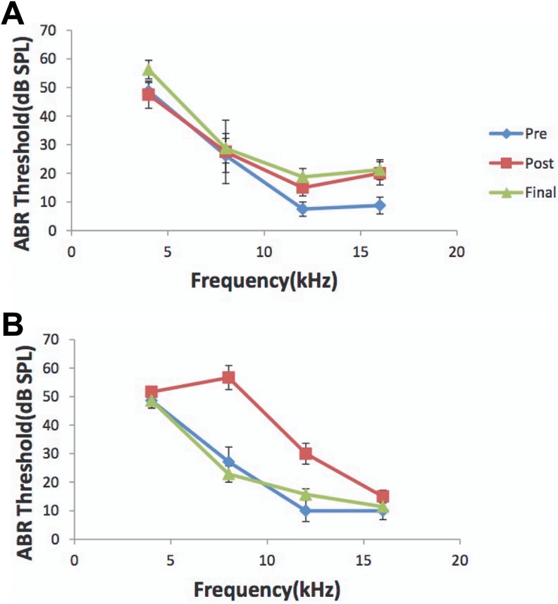 Evaluating Cholinergic Receptor Expression in Guinea Pig Primary Auditory and Rostral Belt Cortices After Noise Damage Using [<sup>3</sup>H]Scopolamine and [<sup>18</sup>F]Flubatine Autoradiography.