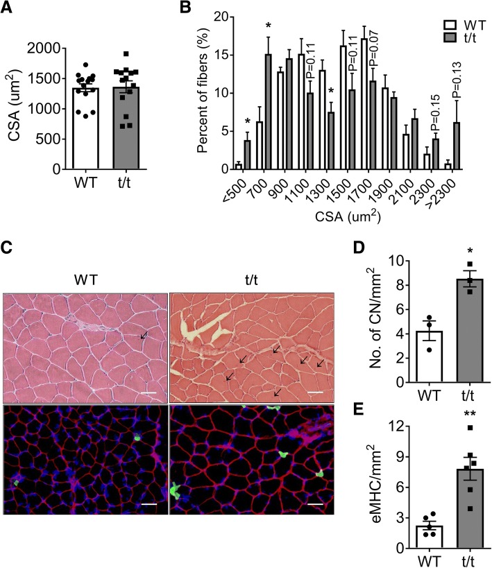 Dilated cardiomyopathy-mediated heart failure induces a unique skeletal muscle myopathy with inflammation.