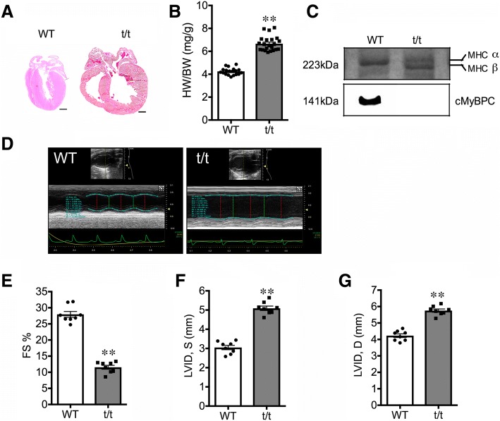 Dilated cardiomyopathy-mediated heart failure induces a unique skeletal muscle myopathy with inflammation.