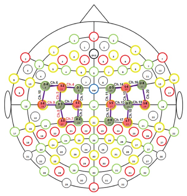 Motor Cortex Function in Fibromyalgia: A Study by Functional Near-Infrared Spectroscopy.