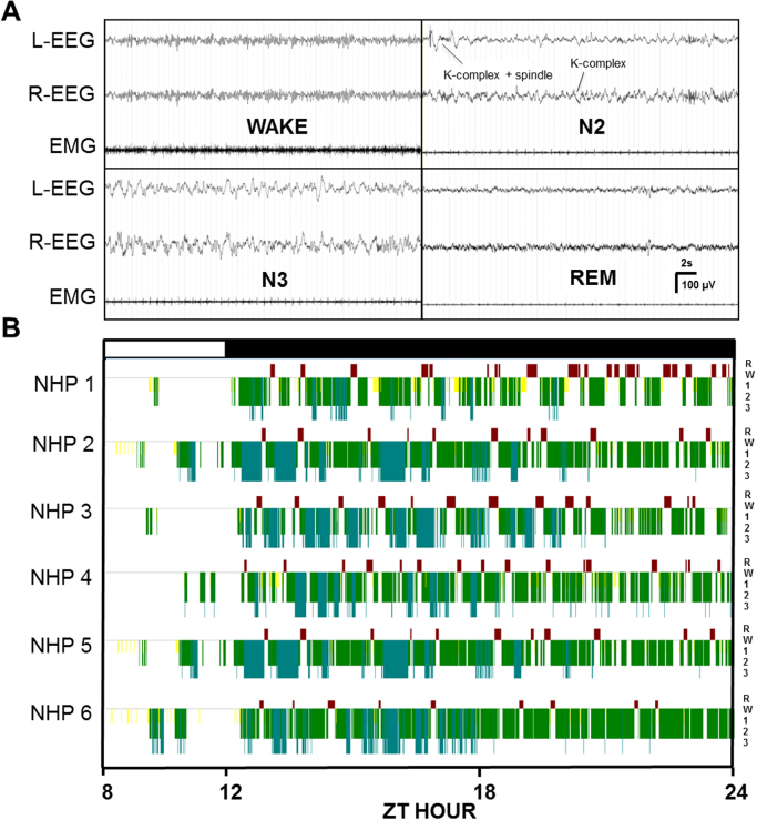 Electrophysiological characterization of sleep/wake, activity and the response to caffeine in adult cynomolgus macaques