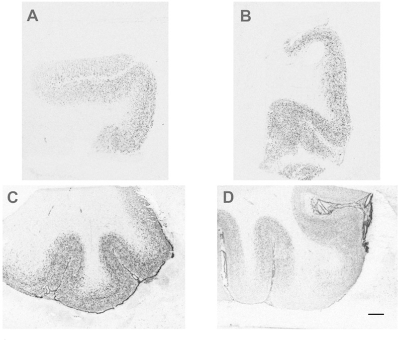 GAD mRNA in Orbital Prefrontal Cortex and Anterior Cingulate Cortex in Alcoholics Compared with Nonpsychiatric Controls: A Negative Postmortem Study.